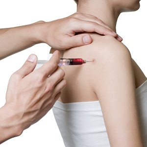 PRP Injection