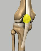 Patella Runner's Knee